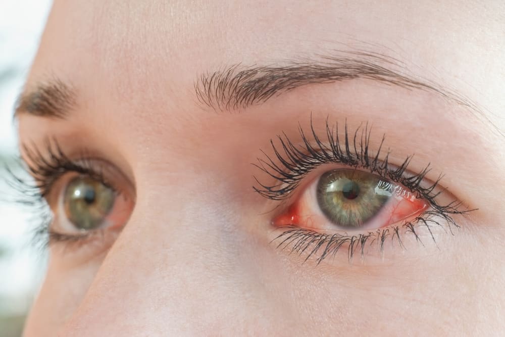 5 Ways You May Be Accidentally Making Your Dry Eye Worse