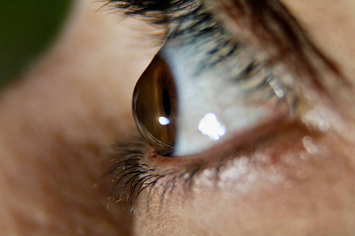 Keratoconus Treatment Has Never Been Easier: Here’s Why